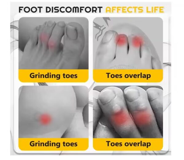 Transparent Gel Toe Protectors (10 pcs) - Image 4